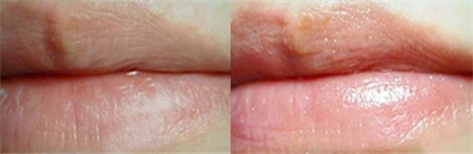 德国小甘菊护手霜出限量礼盒啦！J9国际集团拥有112年历史的(图16)